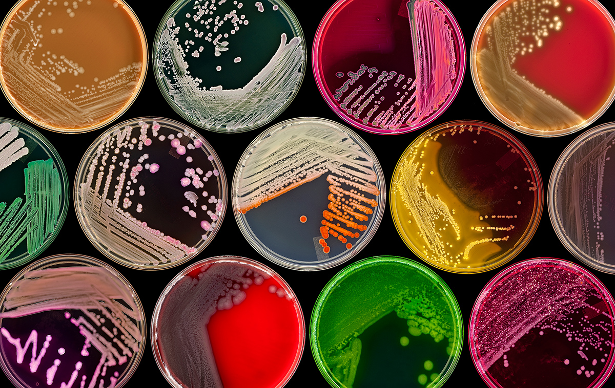 Колонии микроорганизмов в чашке Петри